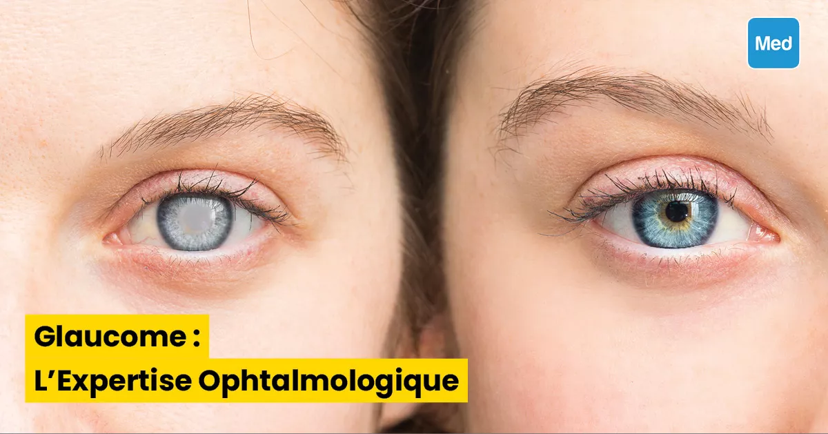 Glaucome : L'Expertise Ophtalmologique